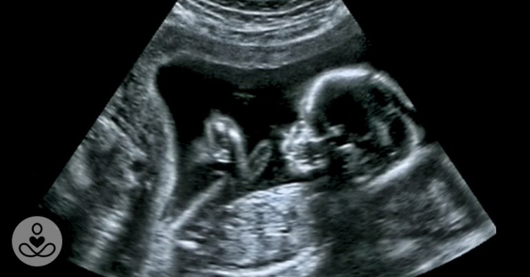 Scientists May Have Actually Found One Of The Causes Of Autism - Featured image