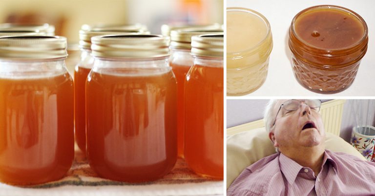 Snoring Remedy: You Can Make This Anti-Snoring Jelly in 7 Minutes - Featured image