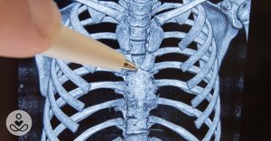 What You Need to Know About the Thymus: A Gland No One Talks About Orig_July17_12_Thymus