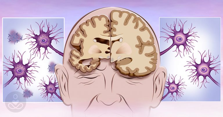 Do You Have ‘Memory Thief Syndrome’? The Link Between Dementia and Hearing Loss - Featured image