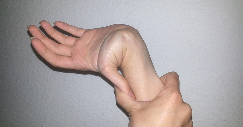 Ehlers-Danlos Syndrome: The Rare Genetic Disorder Stumping Doctors Everywhere - Featured image