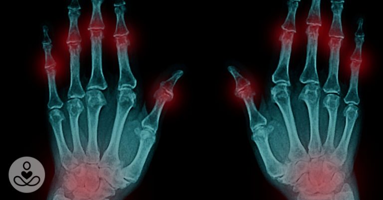 No Drugs Required: Hand Exercises That Reduce Arthritis Pain Fast - Featured image