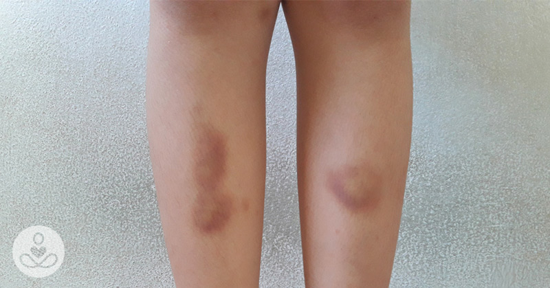 9 Early Warning Signs You Need to Quit Keto - Featured image