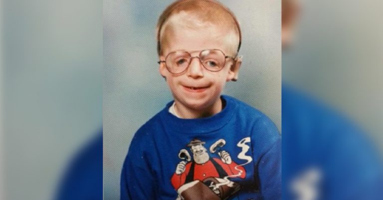How Jono Lancaster Embraced Treacher Collins Syndrome and Is Inspiring Others - Featured image