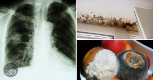 Dec10_Part03_02_Mold