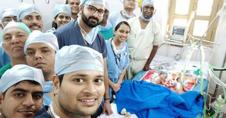 Surgeons Separate Conjoined Twins for Free Because Parents Couldn’t Pay - Featured image