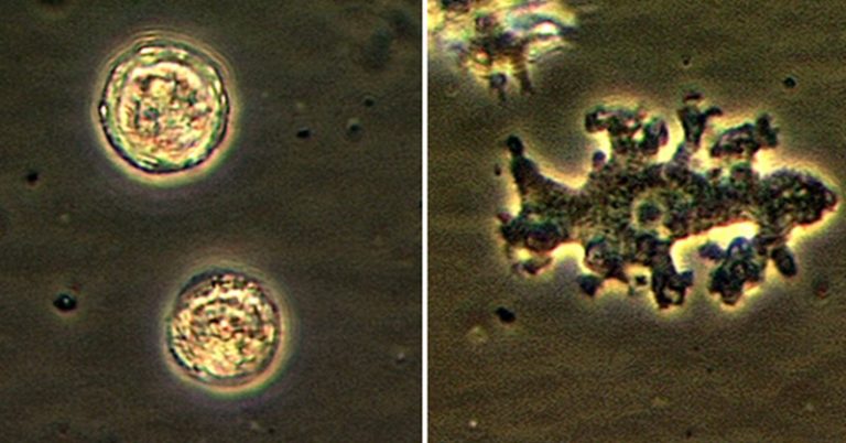Rare Brain-Eating Amoeba Turned Woman’s Brain Into ‘Mush’ While She Was Still Alive - Featured image