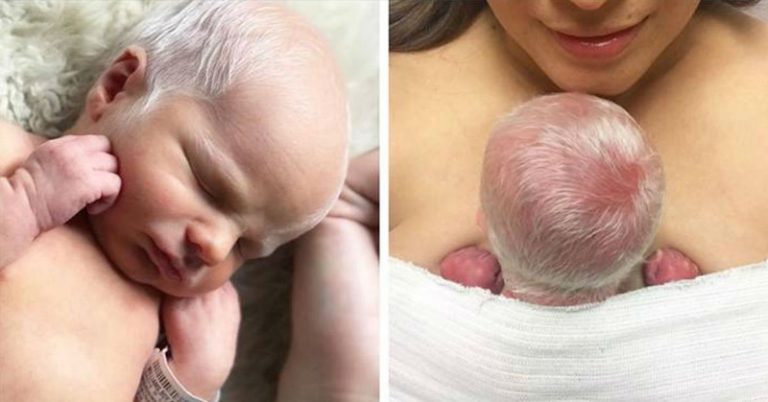 I Gave Birth to the Babies With ‘White’ Hair & This Is What I Need You to Know - Featured image
