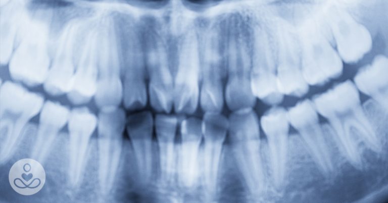 The Cause of Alzheimer’s Could Be Coming From Inside Your Mouth, Study Claims - Featured image