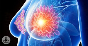 cancer-female