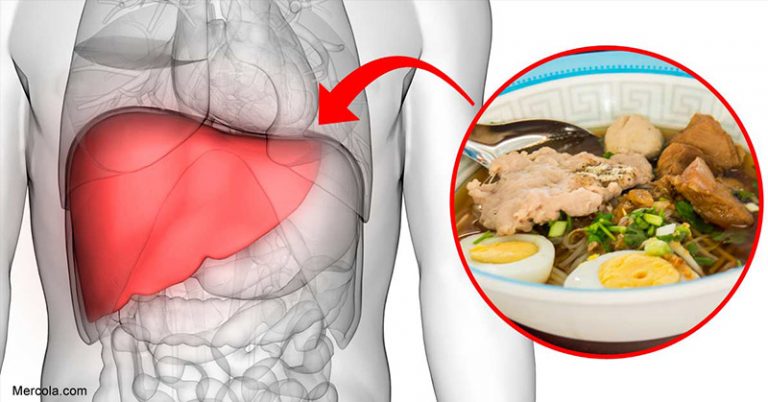 Choline Deficiency Can Trigger Fatty Liver Disease - Featured image