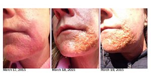 essential-oil-damage