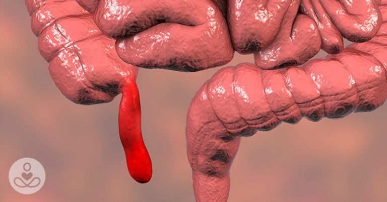 What Exactly Is the Link Between Your Appendix and Parkinson’s? - Featured image