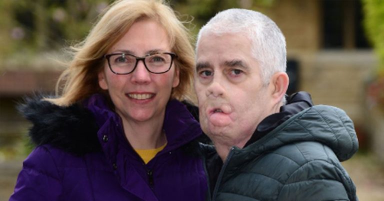 Man Who Lost Arms and Legs to Sepsis Calls for More Awareness and Training - Featured image