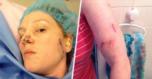 43-Year-Old Tennessee Woman Has Had 86 Skin Cancer Surgeries in the Past 20 Years tanning-bed-warning