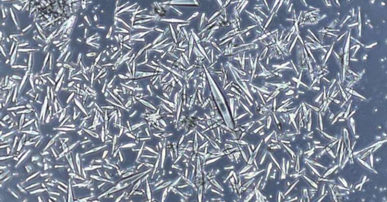 Scientists Solve a Century-Old Mystery to Treat Asthma and Airway Inflammation - Featured image