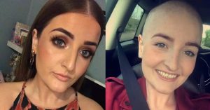 She Was Refused A Smear Test Because She Was 24 and ‘Too Young’. Months Later, She Was Diagnosed With Cervical Cancer. smear