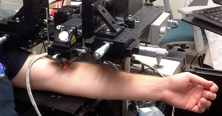 Laser Destroys Cancer Cells Circulating in the Blood - Featured image