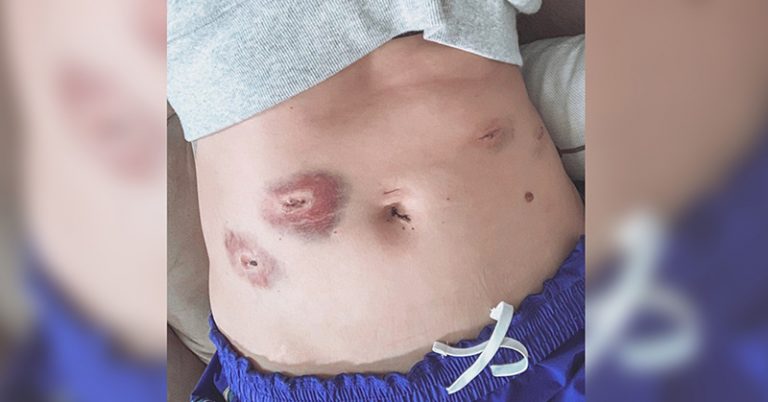 A Face of Endometriosis - Featured image