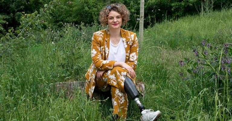 Experience: “I Went Jogging, and I Lost My Leg” - Featured image