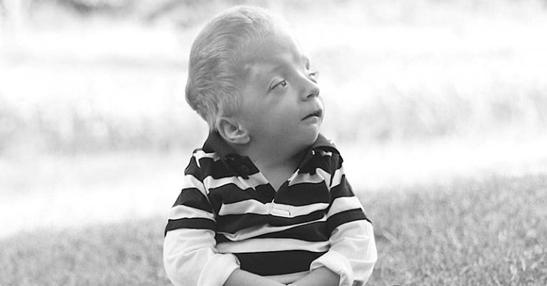 6 Year-Old Boy Battling Disease Baffles Doctors After 36 Surgeries - Featured image