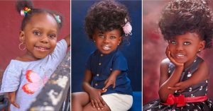 Mom Shares Lovely Photos Of Daughter Born With a Unique Arm little girl born with unique arms