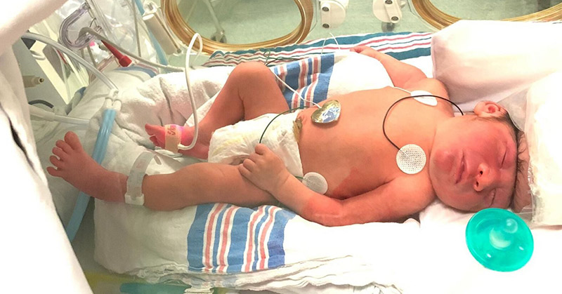 baby born with brain outside of skull