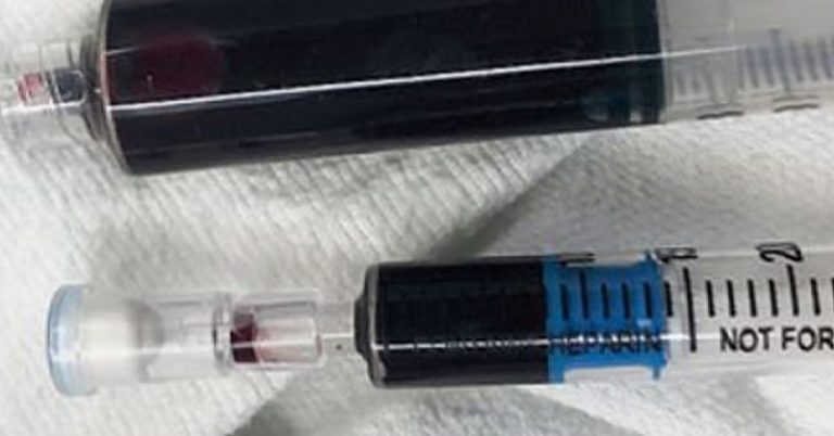 Women Turns Blue From Tooth-Numbing Medication - Featured image