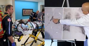 teen who vapes receives double lung transplant