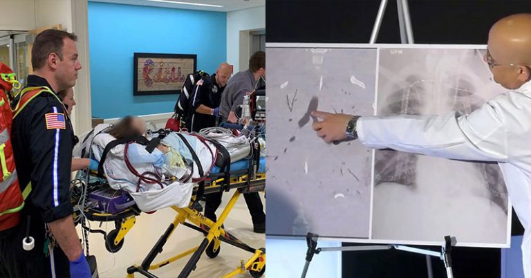 “Stop Vaping, We Beg Of You,” Doctors Warn As 17-Year-Old Who Vaped Receives Double Lung Transplant - Featured image