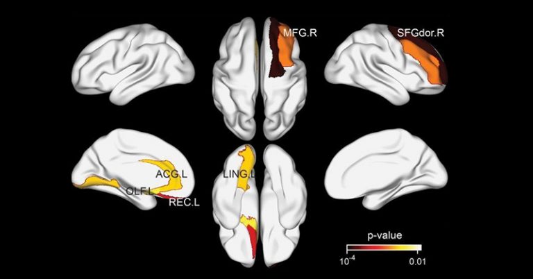 Does Tea Equal a Healthier Brain? Research Points to Yes - Featured image