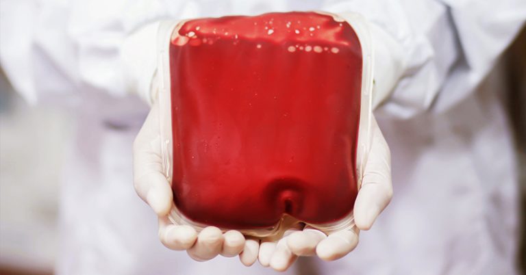 This Controversial Start-Up Charges $8000 to Fill Your Veins With Young Blood - Featured image