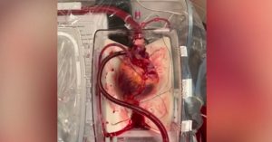 Doctors Brought Dead Heart ‘back to life’ For Groundbreaking Transplant heart brought back to life