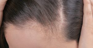 Natural Home Remedies for Hair Growth
