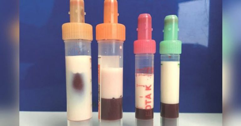 A Man’s Blood Was So Full of Fat, It Turned White And Almost Killed Him - Featured image