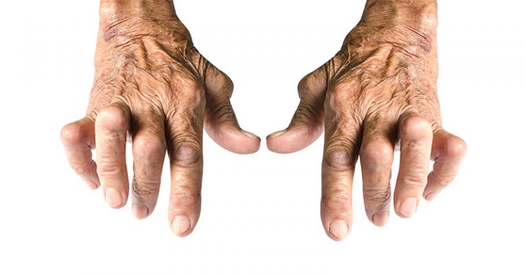 The Cause Of Autoimmune Diseases Like Rheumatoid Arthritis Could Be In Your Fridge - Featured image
