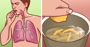 10 home remedies to help with bronchitis and painful coughing attacks home remedies bronchitis