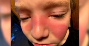 Parents Use Social Media To Warn Others of Strep in The Sinuses parents use social media to warn about strep