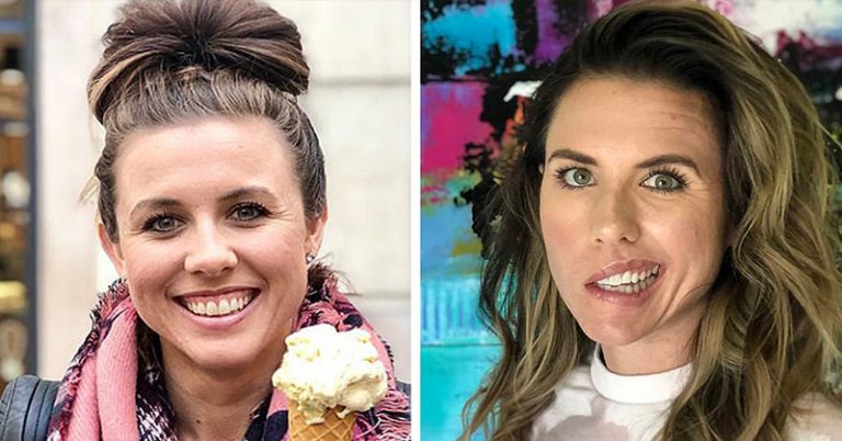 Nutritionist Woke Up With Half Her Face Paralyzed Caused By Stress - Featured image