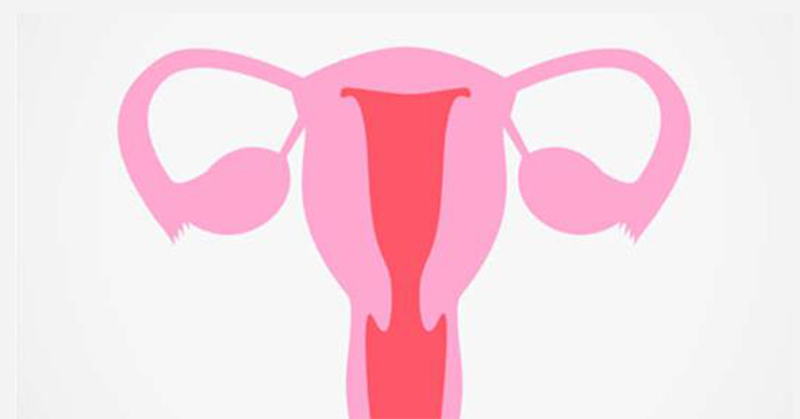 Polycystic Ovary Syndrome: Does Sugar Consumption Affect PCOS? - Featured image