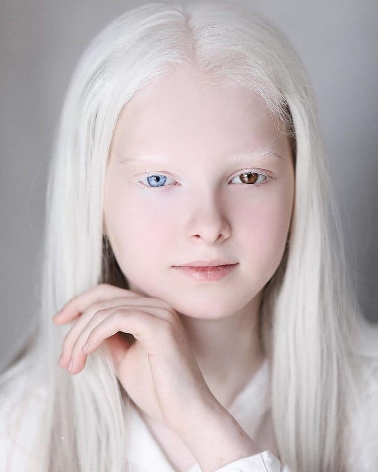 amina albino portrait