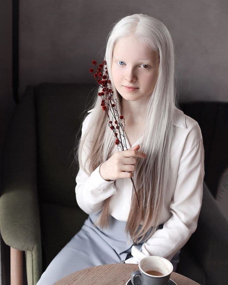 amina albino portrait