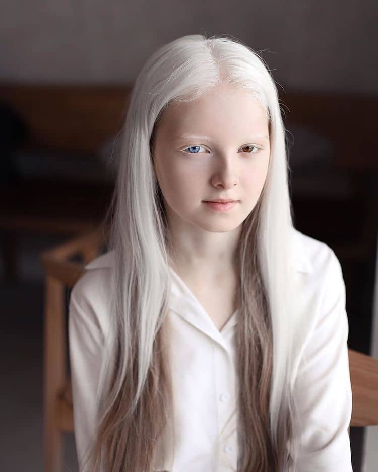 amina albino portriat