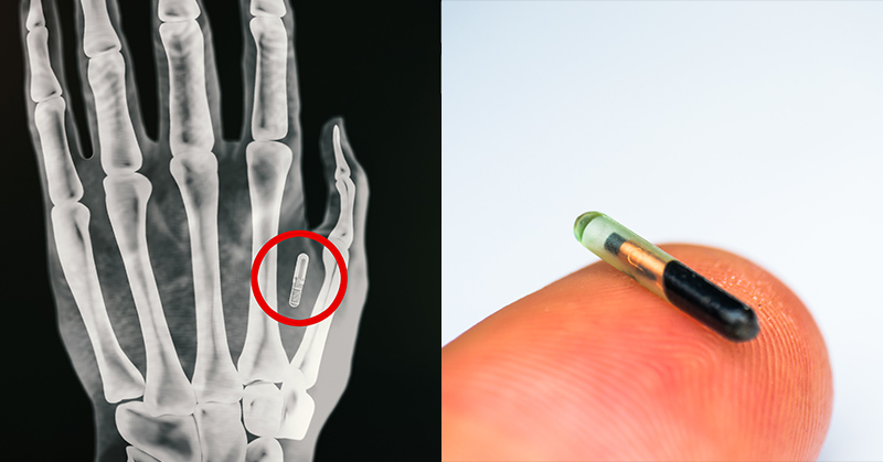 Michigan is trying to make it illegal for companies to put microchips in their employees - Featured image