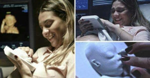Doctors Made A 3D Print Of An Ultrasound For A Blind Expecting Mama 3d ultrasound
