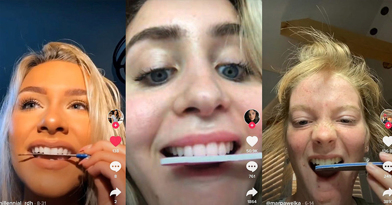 People are shaving down their teeth with nail files to gain followers. Dentists say it could cause permanent damage. - Featured image