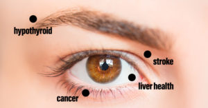 8 Things Your Eyes May be Trying to Tell You About Your Health eye health