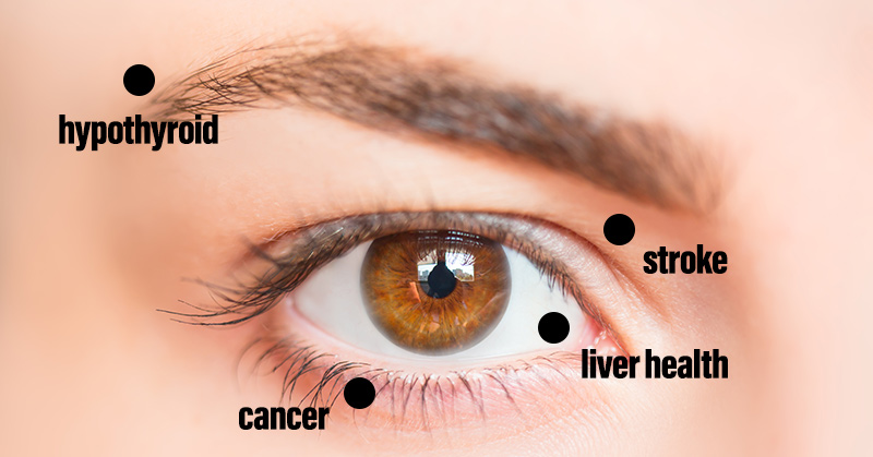 8 Things Your Eyes May be Trying to Tell You About Your Health - Featured image