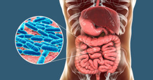 Leaky Gut: What is it? Is it real? And 11 Common Symptoms to Look Out For stomach bacteria