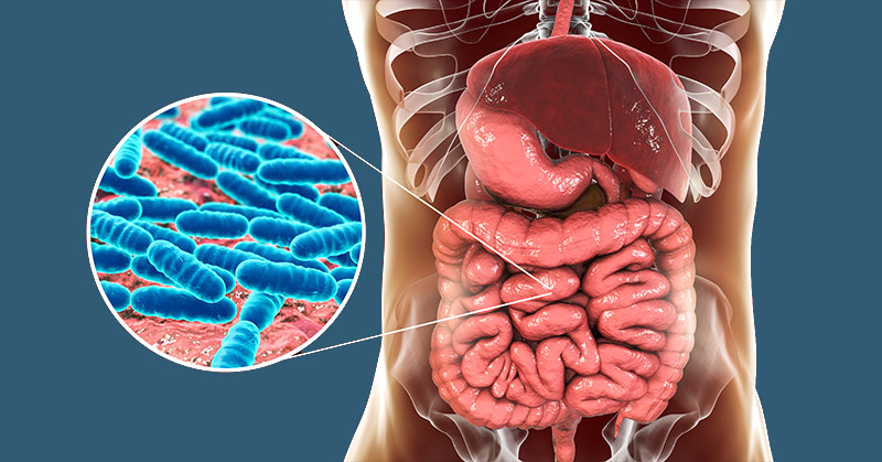 Leaky Gut: What is it? Is it real? And 11 Common Symptoms to Look Out For - Featured image